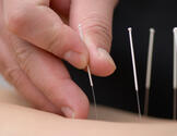  中华针灸中医诊所(中华汉医院)-Chinese Acupuncture & Herbs