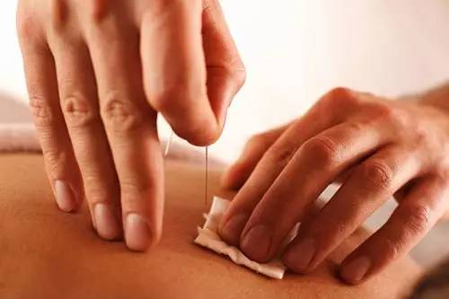 何正中中医针灸院BURLINGAME ACUPUNCTURE CENTER