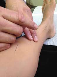 朱伯威中医针灸诊所CHU'S ACUPUNCTURE & HERBS CLINIC